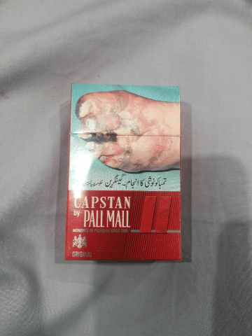 Capstan Sigrat